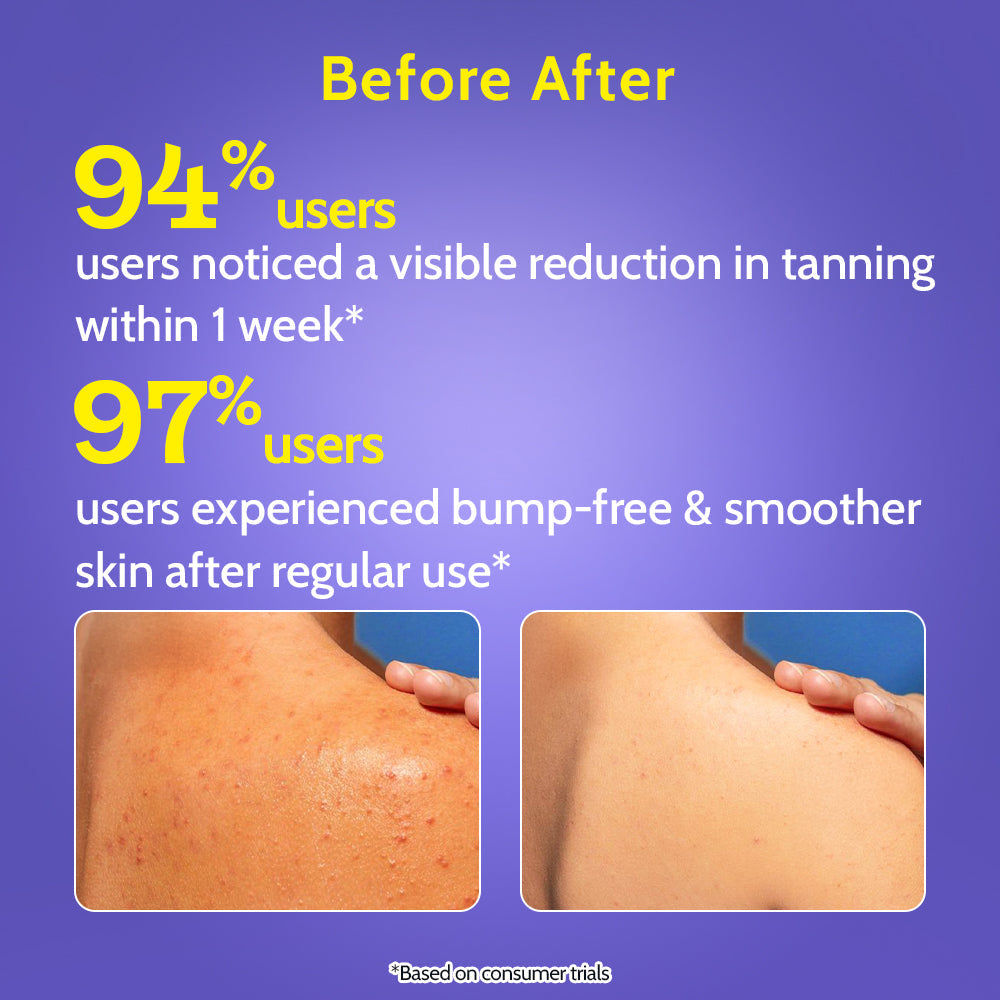 Exfoliating Body Wash with 1% Salicylic Acid & 2% Lactic Acid