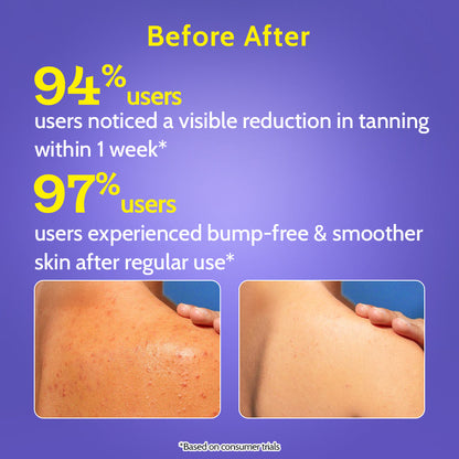 Exfoliating Body Wash with 1% Salicylic Acid & 2% Lactic Acid