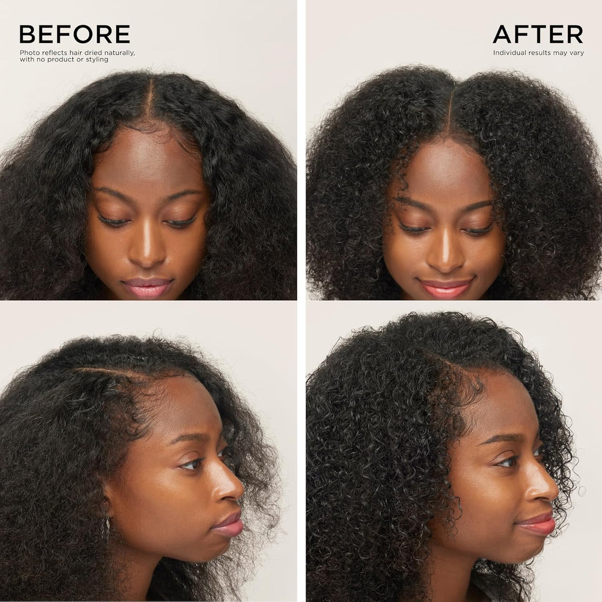 Scalp Revitalizing Solution Hair Thickening Roll On Serum