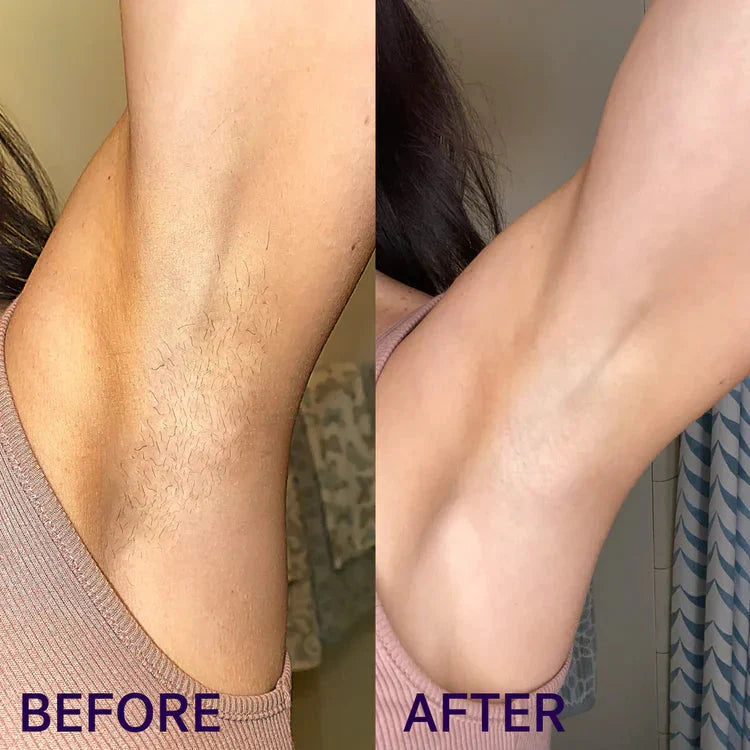 Bikini Hair Removal Cream & Mousse Set – Pain-Free, Gentle & Fast for Sensitive Skin